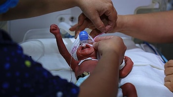 IMSS asegura equipamiento y protocolos