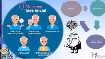 Detección temprana del Alzheimer (Foto: