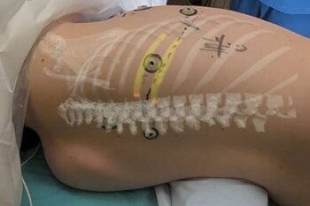 La tecnología proyecta imágenes 3D