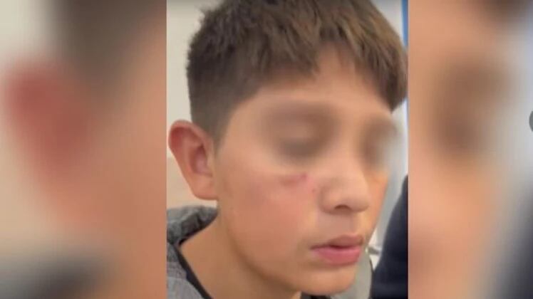 El video de la agresión circuló entre los estudiantes y generó reclamos sobre la actuación institucional