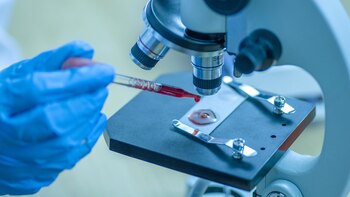 Según la investigación, el anticuerpo