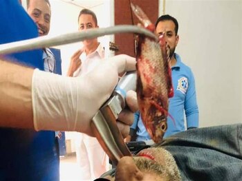 El pez que fue extraído