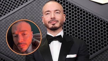 J Balvin reveló quebranto de