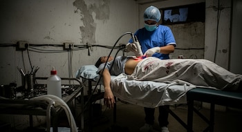 Una persona con uniforme quirúrgico aplica un láser en el abdomen de un paciente en una camilla. La sábana tiene manchas de sangre. La habitación tiene paredes y cables deteriorados.