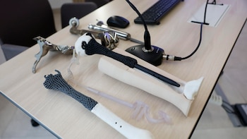 El hospital Gregorio Marañón salva la pierna de Pierre, un paciente con sarcoma, con una prótesis ósea de metamaterial personalizada y pionera en el mundo
