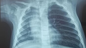 Médicos de Lima y Cusco