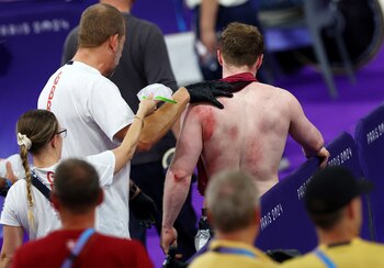 Carlin terminó con heridas superficiales