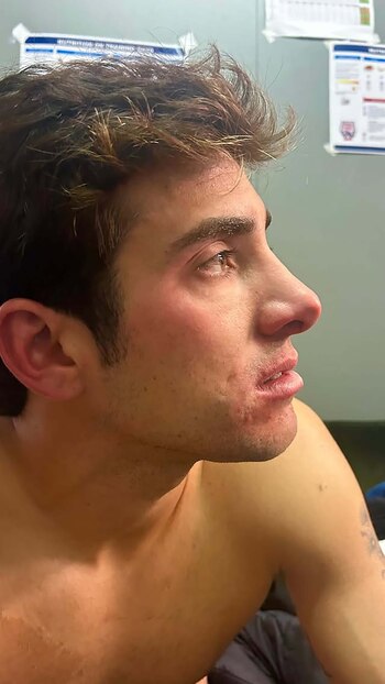 Garin subió una imagen tras el choque en la Copa Davis