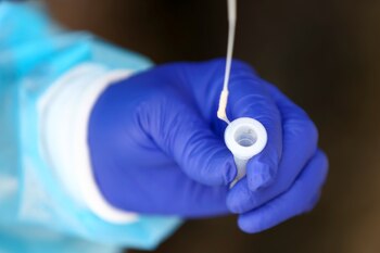 (Foto: EFE/ José Jácome)