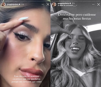 Las secuelas que le quedaron