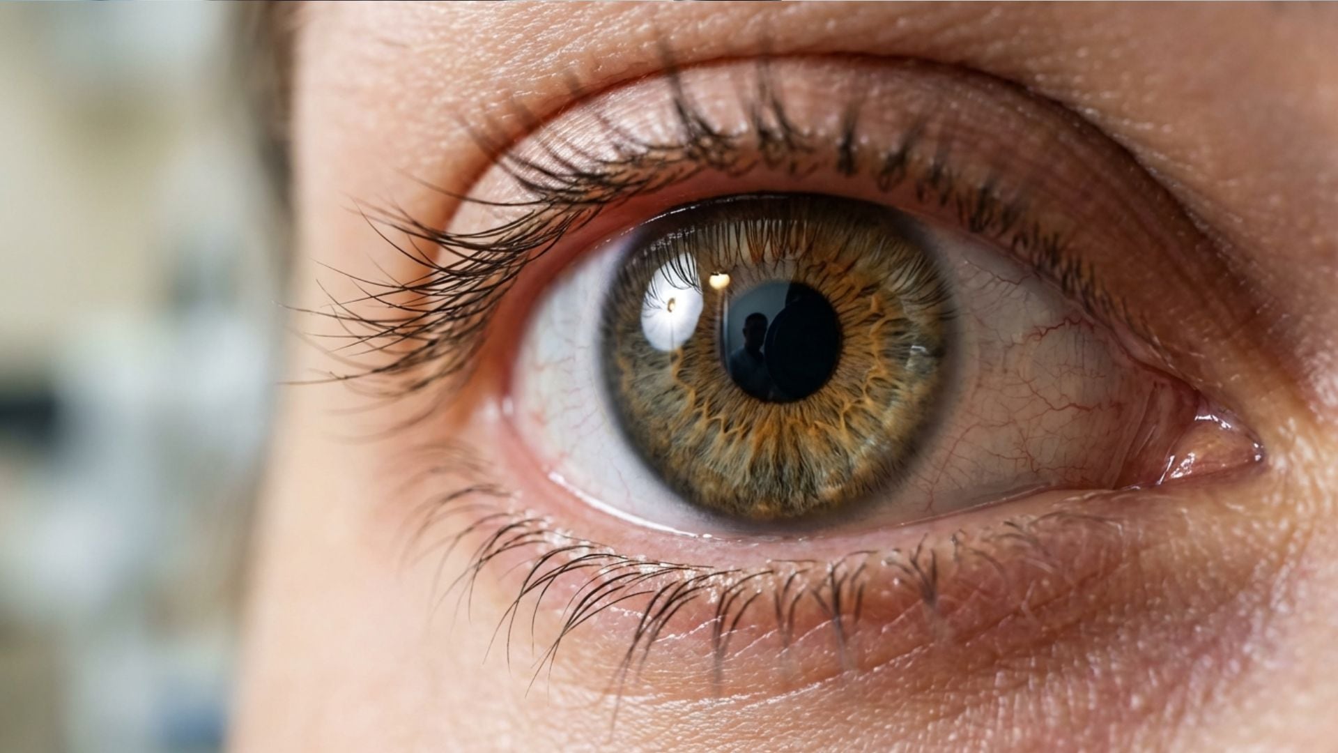 Los betacarotenos, denominados provitamina A, intervienen en la formación de pigmentos necesarios para la retina (Poen)