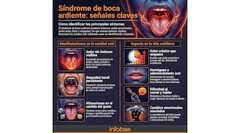 Infografía con título y texto sobre síndrome de boca ardiente. Incluye seis ilustraciones de síntomas orales y efectos en la vida diaria. Logo Infobae.