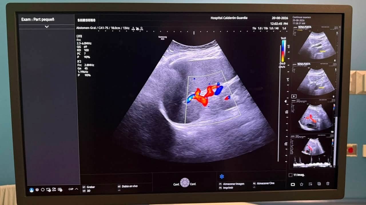 El hospital Calderón Guardia incorpora tres ultrasonidos con inteligencia artificial (Foto cortesía CCSS)