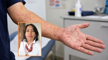La psicóloga Susana Ramírez advierte que el hallazgo de la enfermedad suele sorprender y provoca ansiedad, inseguridad y cuestionamientos sobre la vida sexual y el vínculo afectivo - crédito Imagen Ilustrativa Infobae - Suministrada a Infobae