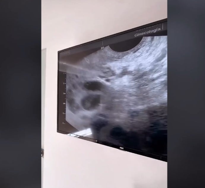 Karla Tarazona y Christian Domínguez vuelven a clínica de fertilidad y desatan rumores de embarazo. Infobae Perú / Captura: IG.