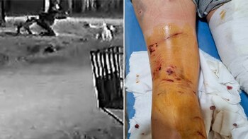 Habló la joven atacada por