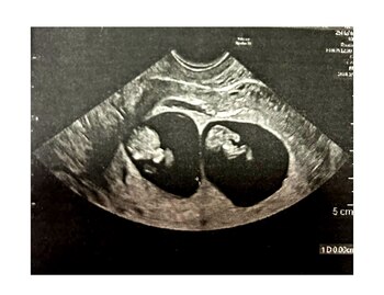 Matías durante 28 años buscó