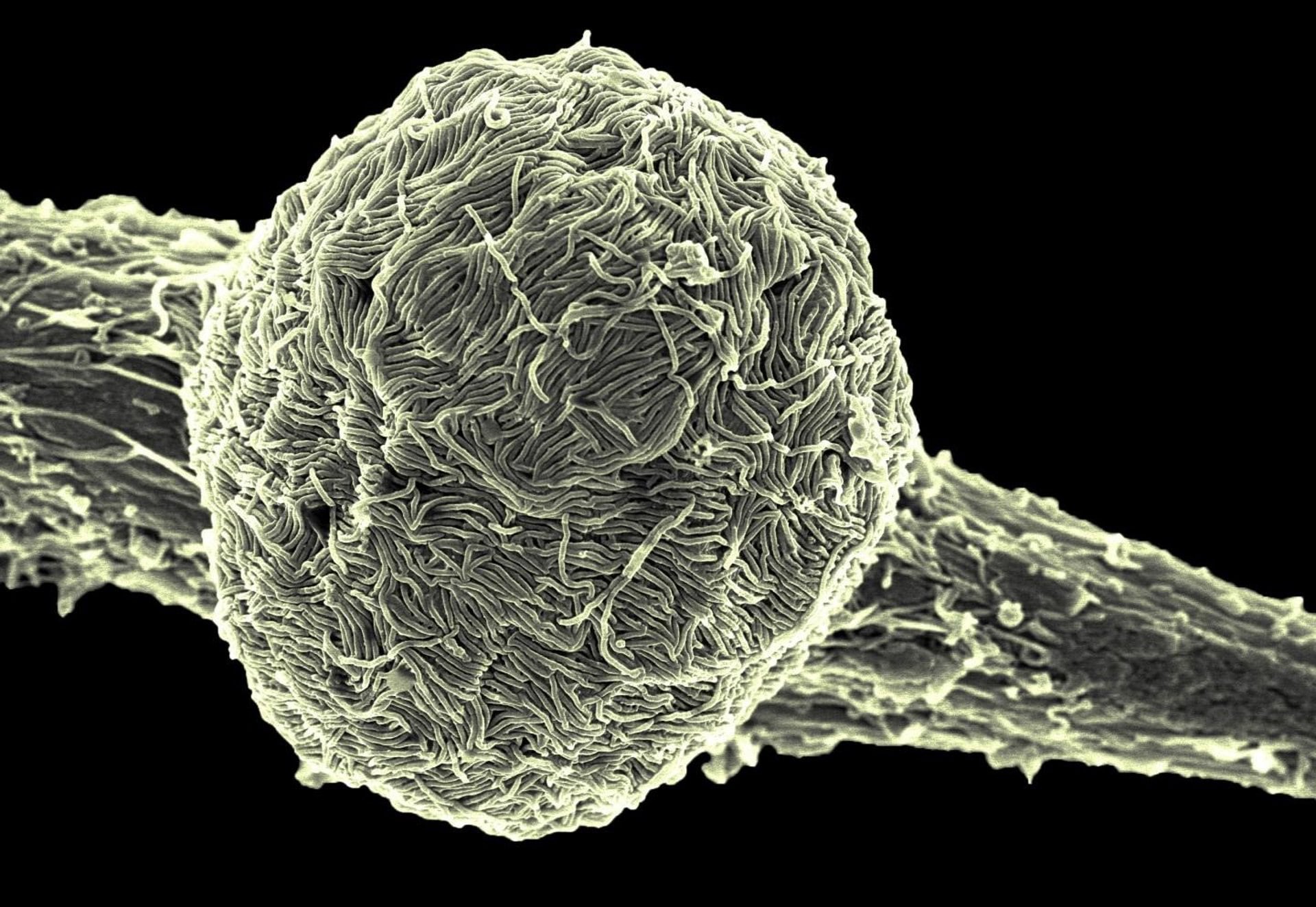 21/10/2019 La variante Makona del virus del ébola cubre la superficie de una célula infectada.
SOCIEDAD SALUD
NIAID
