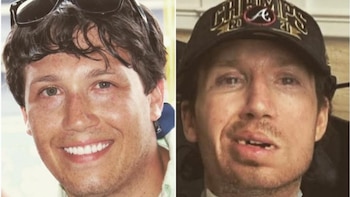 Jonathan Buckelew,, antes y después.