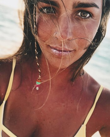 "Hoy convivo con mis heridas,