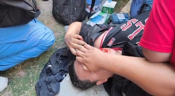 Una persona fue reportada como herida, como resultado del enfrentamiento