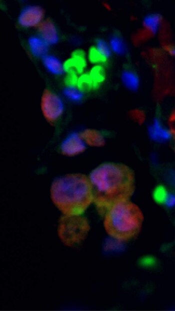 Tejido pulmonar de un paciente humano con daño pulmonar crónico. Las células senescentes se destacan por su expresión de las proteínas p16 (rojo) y PD-L1 (verde). Los núcleos celulares están en azul (Instituto Weizmann)