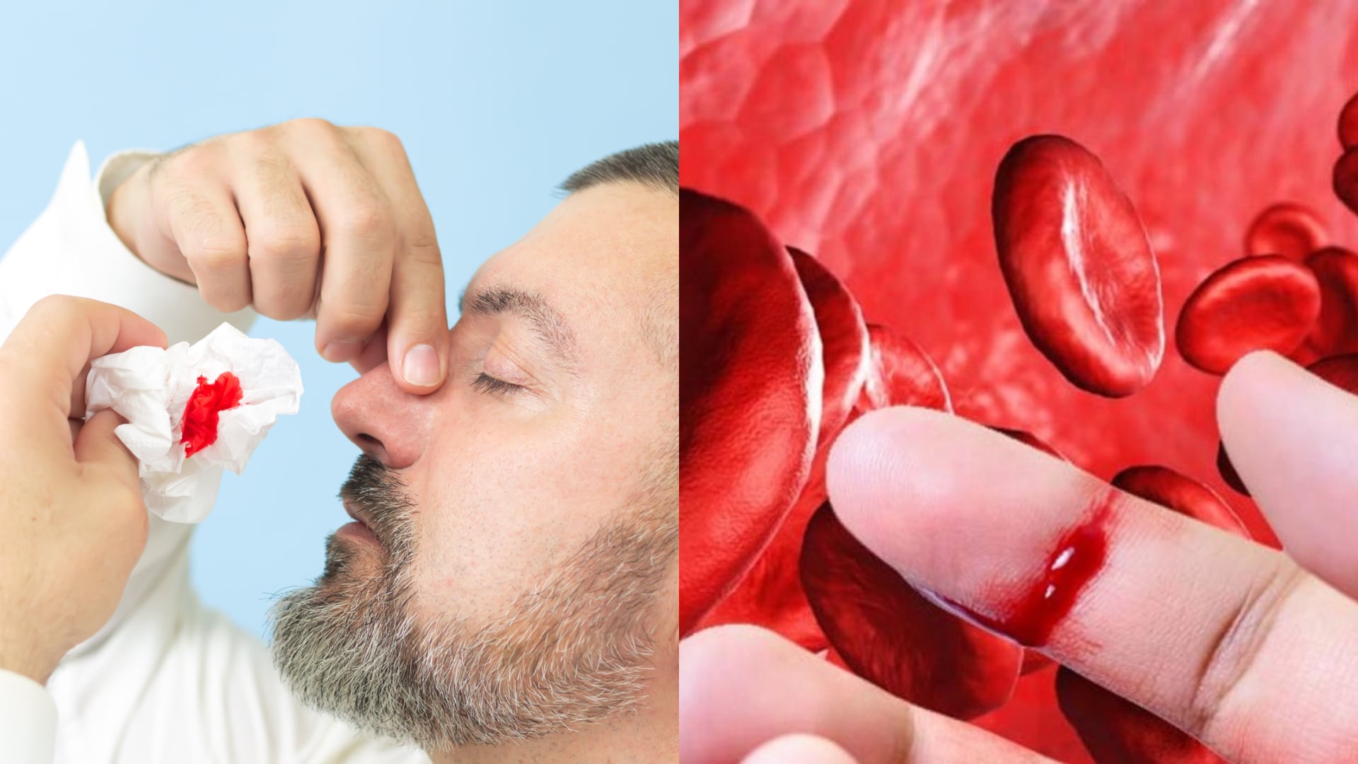 En este 17 de abril se destaca la importancia de reconocer la hemofilia, una enfermedad rara, buscando mejorar la calidad de vida de quienes la padecen. (Clínica San Pablo / CMUC)