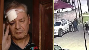 Un jubilado sufrió un violento