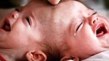 Theresia no estaba mejor emocionalmente