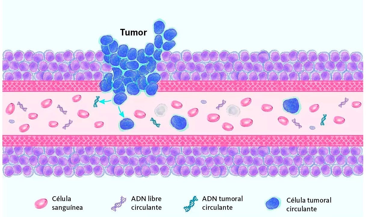 El método desarrollado por científicos de Johns Hopkins analiza más de 40 millones de fragmentos de ADN por paciente en cada estudio (SYSMEX)