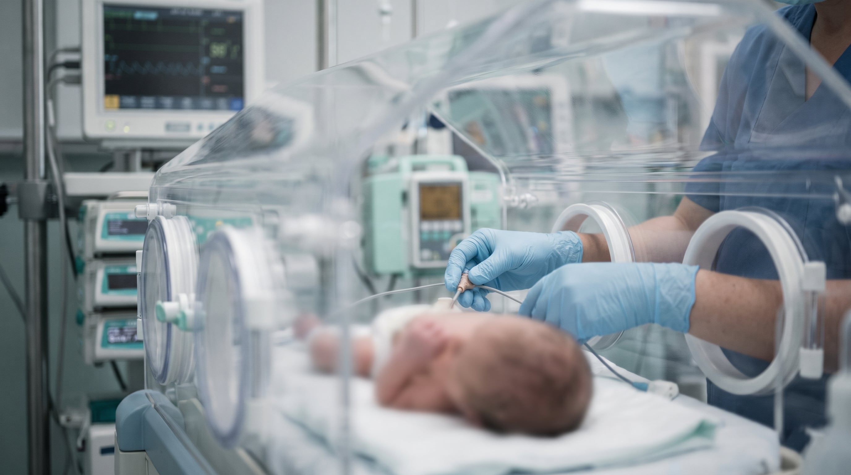 Un profesional sanitario ajusta un sensor médico a un recién nacido dentro de una incubadora en una sala de neonatología. (Imagen Ilustrativa Infobae)