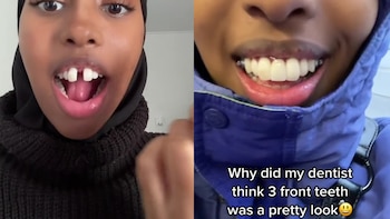 El dentista le puso tres