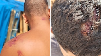 Amnistía Internacional denuncia “tortura y tratos crueles” de militares españoles a los migrantes en Ceuta: “Cuando terminaron, me tiraron por un terraplén”