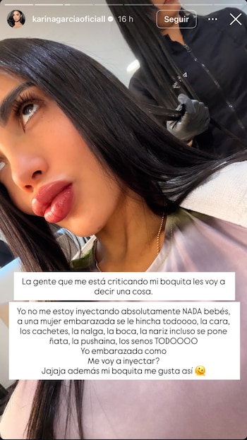Karina García responde a críticas sobre sus labios y aclara cambios físicos durante el embarazo - crédito karinagarciaoficiall/Instagram