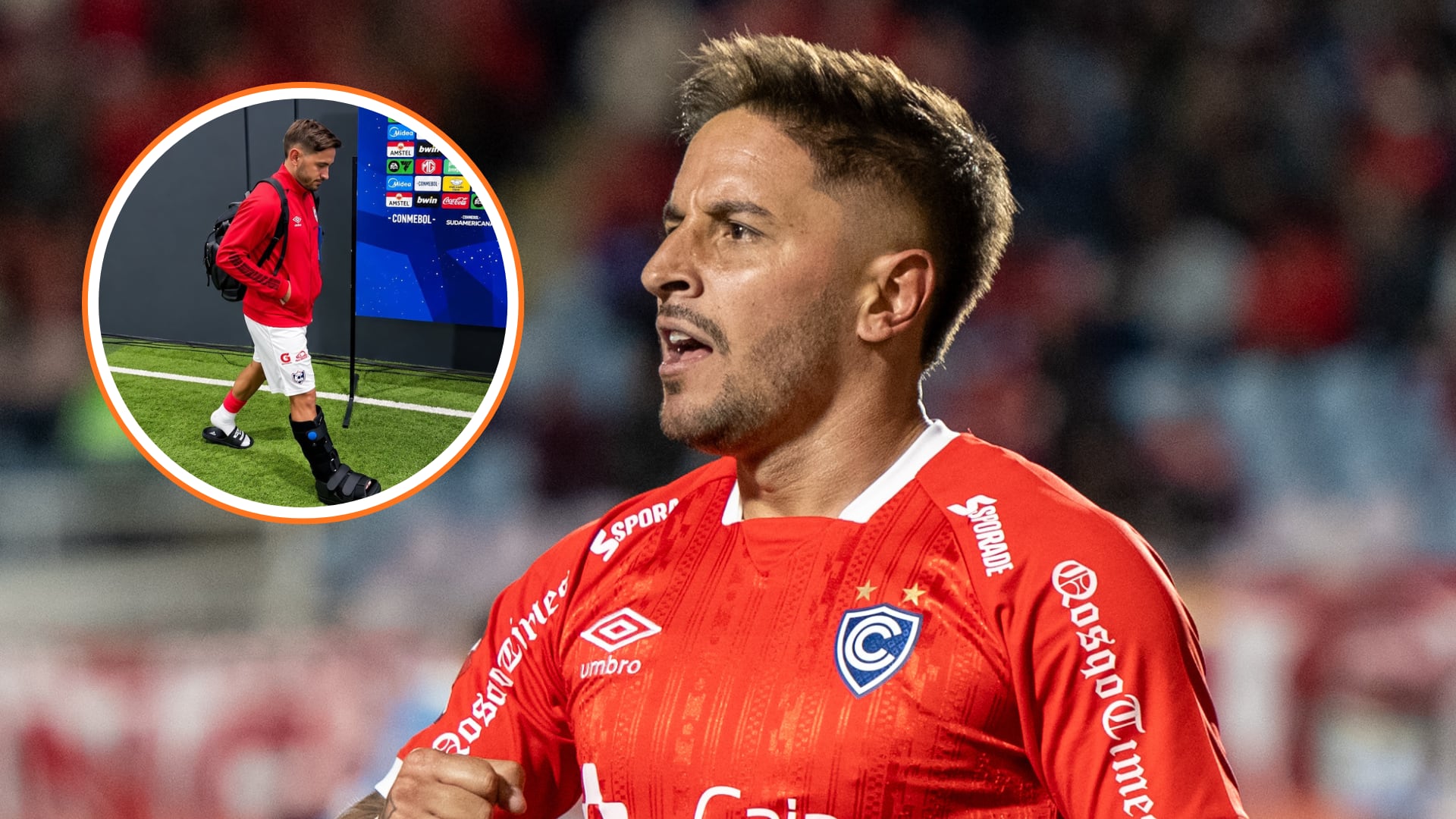 Alejandro Hohberg sufrió lesión en el partido de ida entre Cienciano y Montevideo City Torque, disputado en el Cusco. Crédito: LFP
