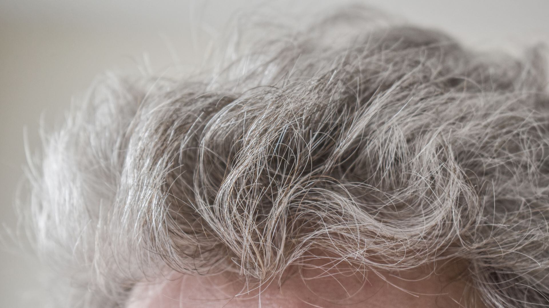 Especialistas de UCLA Health y el National Institutes of Health subrayan el impacto de la reducción en la producción de melanina en la salud capilar (Canva)