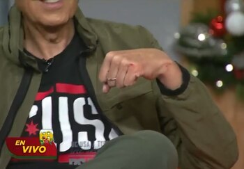 Bisogno se lastimó ambas manos