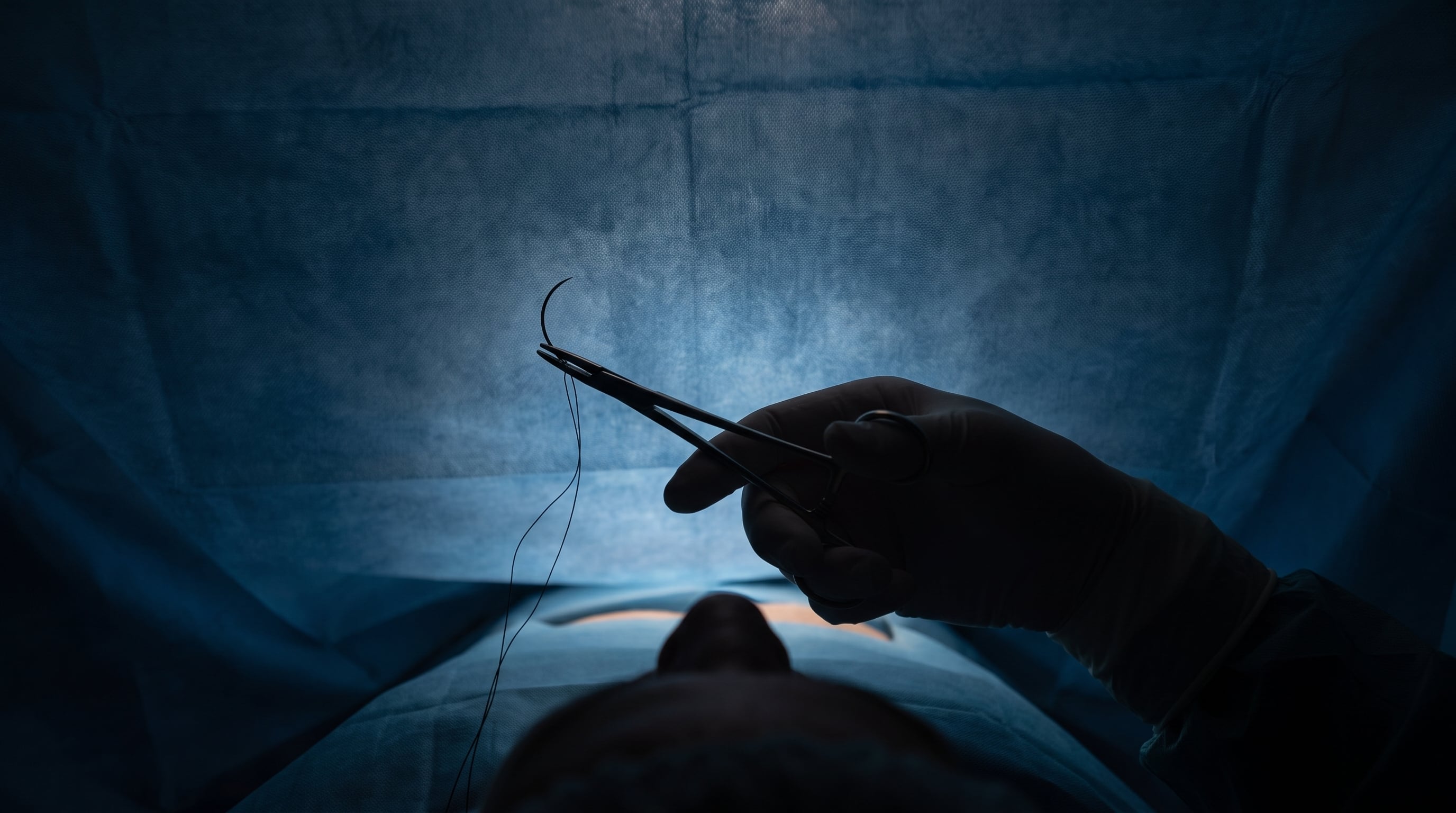 Investigado por la muerte de una paciente tras una liposucción huyó de República Dominicana hacia Colombia