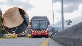 Mujer denuncia que resultó herida