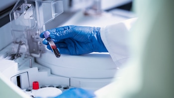 Una terapia experimental elimina el cáncer metastásico de hígado en un niño de tres años