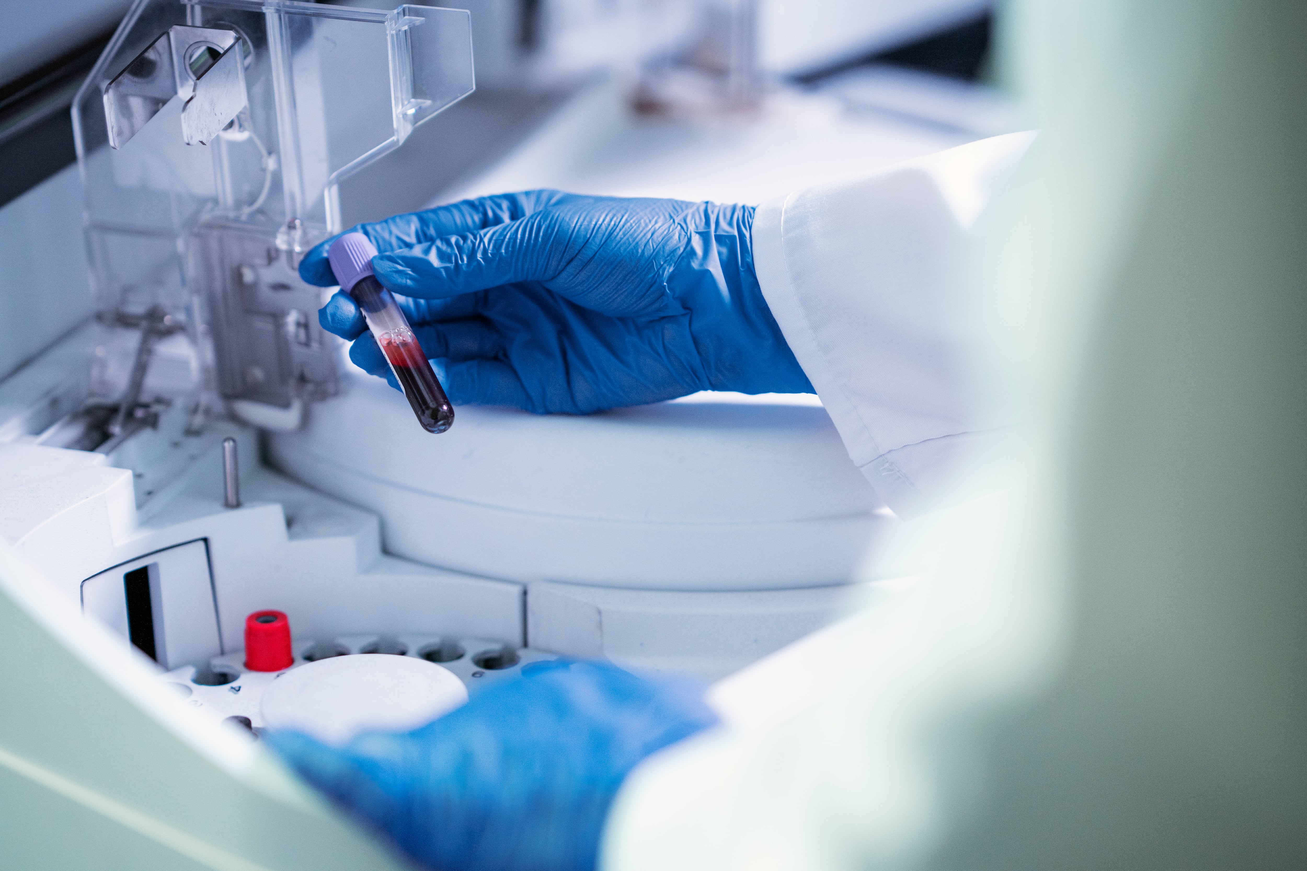 Científicos manipulando unas muestras de sangre en un laboratorio (Magnific)