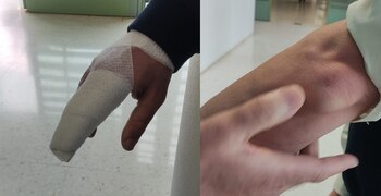 Algunas de las agresiones causadas