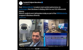 Remote surgery: France manages to remove a tumor from a patient in China with technology Remote surgery: France manages to remove a tumor from a patient in China with technology