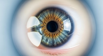 Primer plano de un ojo humano con iris azul y marrón, pupila negra, y reflejo de una lente en la córnea. Fondo azul pálido y blanco desenfocado.