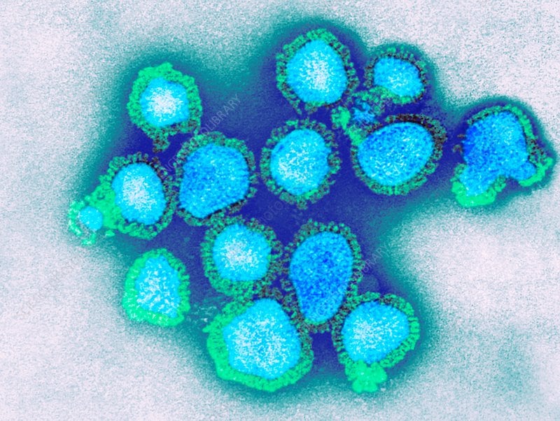 Una imagen microscópica colorizada del virus de la influenza A (H3N2), subclado K