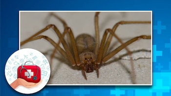 Primeros auxilios: cómo actuar si