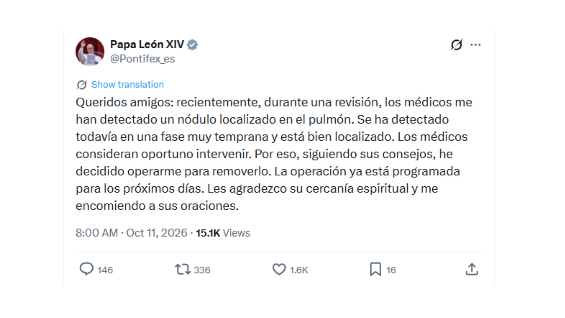 El papa León XIV anunció que será operado por un nódulo en el pulmón| Foto: X