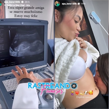 Epa Colombia mostró en sus