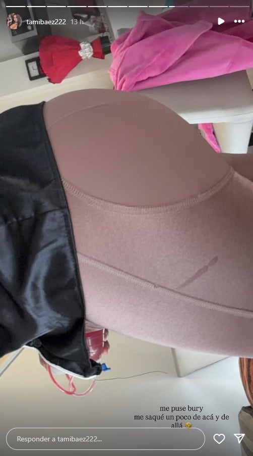 Tamara Báez mostró el resultado de su cirugía de glúteos llamada