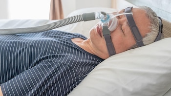 Marcapasos de lengua podría mejorar la salud de los pacientes con apnea del sueño